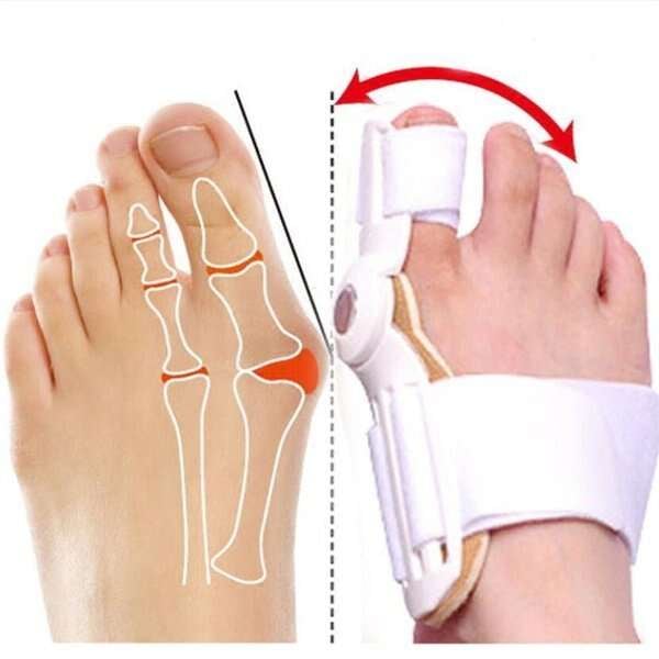 đ„hot SALE- ăLĂ€kare Rekommenderadă Bunion Corrector för mĂ€n och kvinnor
