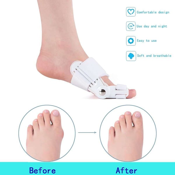 đ„hot SALE- ăLĂ€kare Rekommenderadă Bunion Corrector för mĂ€n och kvinnor