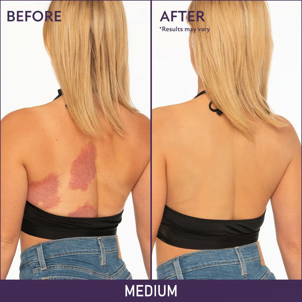 🔥 SISTA DAGEN 49% RABATT🔥Mjuk Matt Kräm Concealer