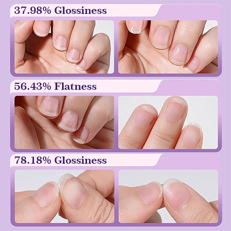 💅✨Nail Essence Pen i fickstorlek – Din 2,5 ml salongsklassade nagelvård när du är på språng!