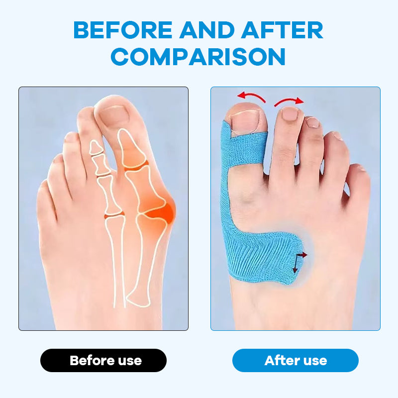 Färdigskuren kinesiologitejp för hallux valgu