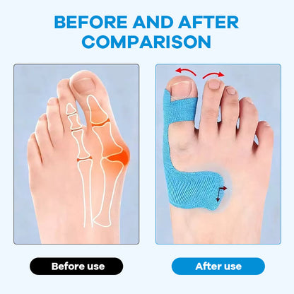 Färdigskuren kinesiologitejp för hallux valgu